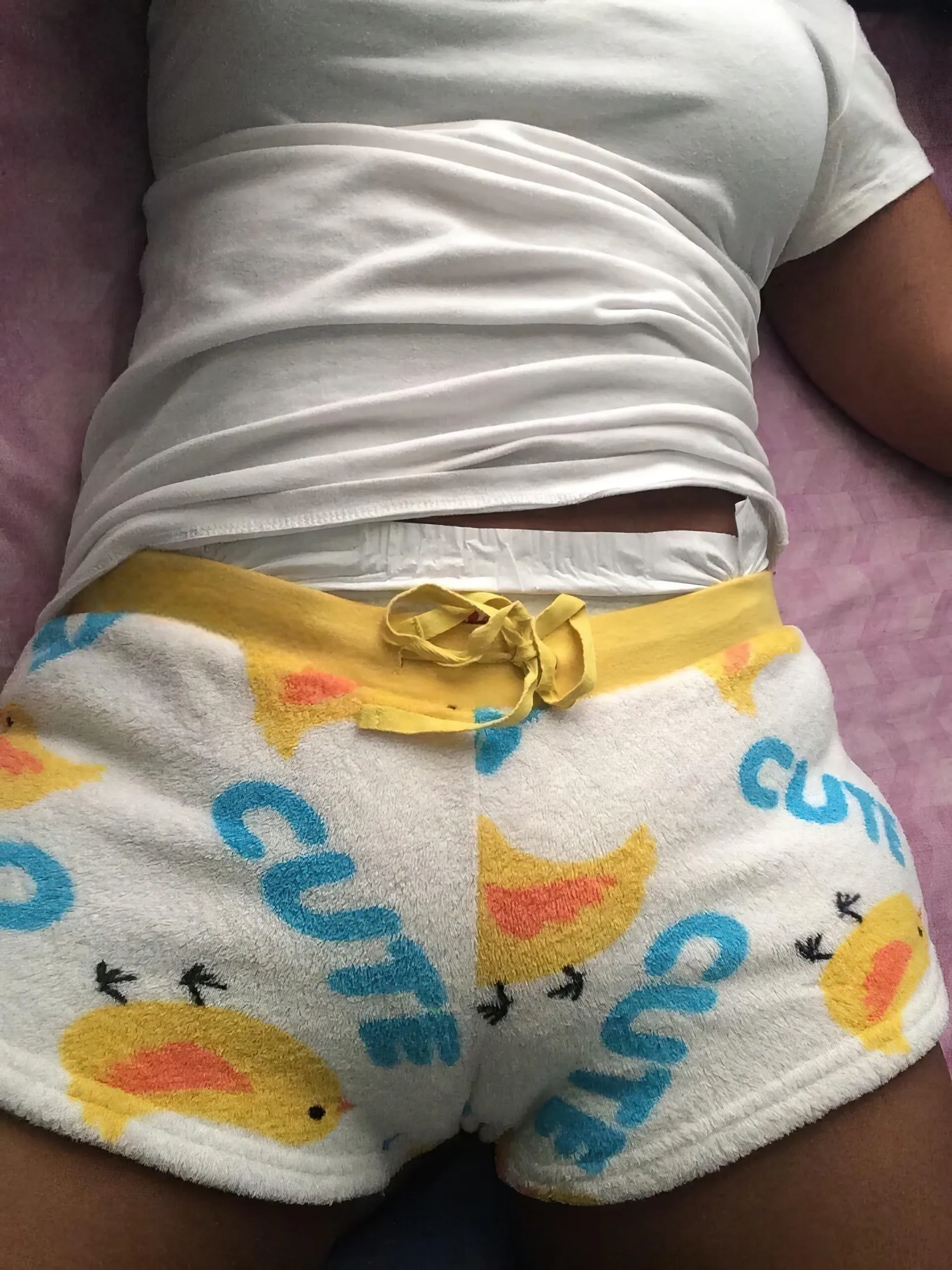 The waistband of a white diaper is visible beneath the soft shorts of an ABDL girl.